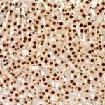HNF6 Antibody in Immunohistochemistry (Paraffin) (IHC (P))