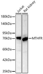 MTHFR Recombinant Rabbit Monoclonal Antibody (6Q5C1)