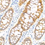 PER1 Antibody in Immunohistochemistry (Paraffin) (IHC (P))