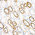 PER1 Antibody in Immunohistochemistry (Paraffin) (IHC (P))