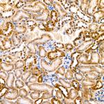 PER1 Antibody in Immunohistochemistry (Paraffin) (IHC (P))