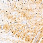 PER1 Antibody in Immunohistochemistry (Paraffin) (IHC (P))