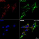 BNIP3L Antibody in Immunocytochemistry (ICC/IF)