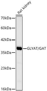 GLYAT Recombinant Rabbit Monoclonal Antibody (4F9J6)