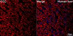 OTC Antibody in Immunohistochemistry (Paraffin) (IHC (P))