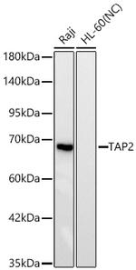 TAP2 Antibody in Western Blot (WB)