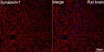 Synapsin 1 Antibody in Immunohistochemistry (Paraffin) (IHC (P))