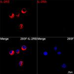 CD122 Recombinant Rabbit Monoclonal Antibody (6R8P4)