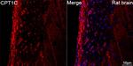 CPT1C Antibody in Immunohistochemistry (Paraffin) (IHC (P))