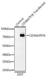 PI16 Recombinant Rabbit Monoclonal Antibody (9Z5V7)