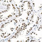 DNA-PK Antibody in Immunohistochemistry (Paraffin) (IHC (P))