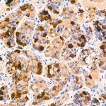 Follicle Stimulating Hormone Recombinant Rabbit Monoclonal Antibody (6R1V3)