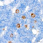 TGF beta-1 Recombinant Rabbit Monoclonal Antibody (9G3E3)