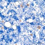 TGF beta-1 Antibody in Immunohistochemistry (Paraffin) (IHC (P))