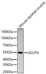 GLUT4 Recombinant Rabbit Monoclonal Antibody (7Y4R9)