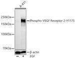 Phospho-VEGF Receptor 2 (Tyr1175) Antibody in Western Blot (WB)