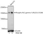 Phospho-PLCG1 (Ser1248) Recombinant Rabbit Monoclonal Antibody (4I4E6)