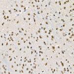 Phospho-Beclin 1 (Ser90) Antibody in Immunohistochemistry (Paraffin) (IHC (P))