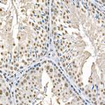 Phospho-Beclin 1 (Ser90) Antibody in Immunohistochemistry (Paraffin) (IHC (P))