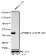 Phospho-CaMKII alpha (Thr286) Recombinant Rabbit Monoclonal Antibody (9Y1Y5)