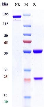CD19 (Tafasitamab Biosimilar) Antibody in SDS-PAGE (SDS-PAGE)