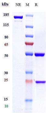 Rituximab Chimeric Antibody in SDS-PAGE (SDS-PAGE)