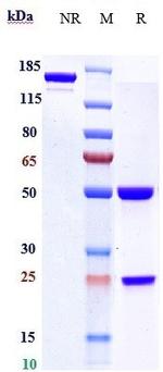 Varlilumab Antibody in SDS-PAGE (SDS-PAGE)