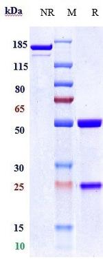 CD37 (Naratuximab Biosimilar) Antibody in SDS-PAGE (SDS-PAGE)