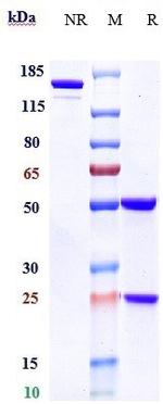 Daratumumab Antibody in SDS-PAGE (SDS-PAGE)