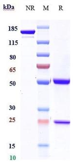 Ipilimumab Antibody in SDS-PAGE (SDS-PAGE)