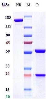 Quetmolimab Humanized Recombinant Human Monoclonal Antibody
