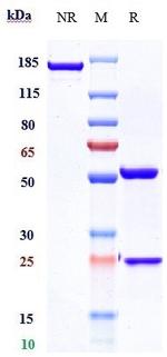 CXCR4 (CD184) (Ulocuplumab Biosimilar) Antibody in SDS-PAGE (SDS-PAGE)