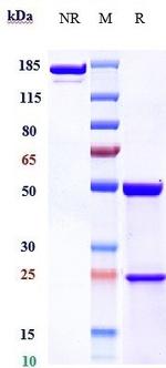 FCRN (Rozanolixizumab Biosimilar) Antibody in SDS-PAGE (SDS-PAGE)