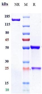 Aprutumab Antibody in SDS-PAGE (SDS-PAGE)