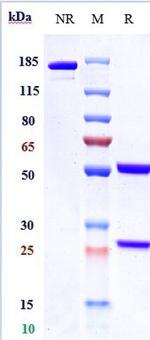 Glypican 3 (Codrituzumab Biosimilar) Antibody in SDS-PAGE (SDS-PAGE)