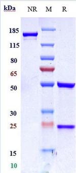 Her-2 (ErbB2) (Disitamab Biosimilar) Antibody in SDS-PAGE (SDS-PAGE)