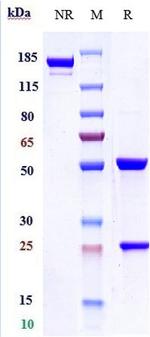 Her-2 (ErbB2) (Trastuzumab Biosimilar) Antibody in SDS-PAGE (SDS-PAGE)