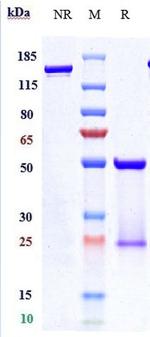 Her-2 (ErbB2) (Pertuzumab Biosimilar) Antibody in SDS-PAGE (SDS-PAGE)