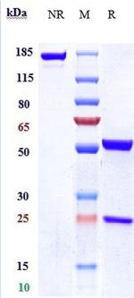 IL-18 (Aletekutug Biosimilar) Antibody in SDS-PAGE (SDS-PAGE)