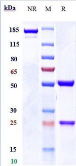 Nidanilimab Antibody in SDS-PAGE (SDS-PAGE)