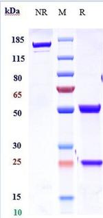IL-21 Biosimilar Recombinant Human Monoclonal Antibody