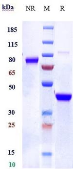 Vobarilizumab Humanized Antibody in SDS-PAGE (SDS-PAGE)