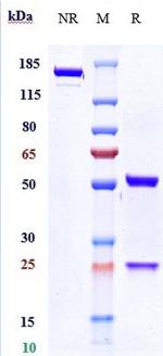 Tocilizumab Humanized Antibody in SDS-PAGE (SDS-PAGE)