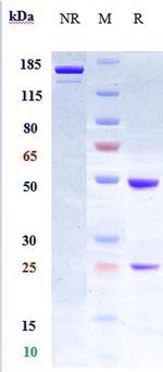 LIF Humanized Biosimilar Antibody in SDS-PAGE (SDS-PAGE)