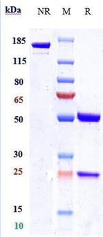 Nectin 4 (Enfortumab Biosimilar) Antibody in SDS-PAGE (SDS-PAGE)