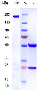 Tesnatilimab Antibody in SDS-PAGE (SDS-PAGE)