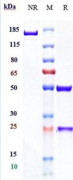 Spartalizumab Humanized Antibody in SDS-PAGE (SDS-PAGE)
