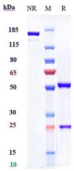Durvalumab Antibody in SDS-PAGE (SDS-PAGE)
