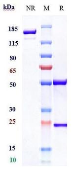 PSMA (Rosopatamab Biosimilar) Antibody in SDS-PAGE (SDS-PAGE)