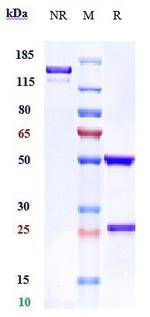 ROR1 (Zilovertamab Biosimilar) Antibody in SDS-PAGE (SDS-PAGE)